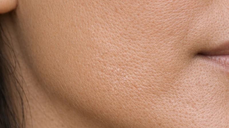 Subtle dry surface texture on a cheek