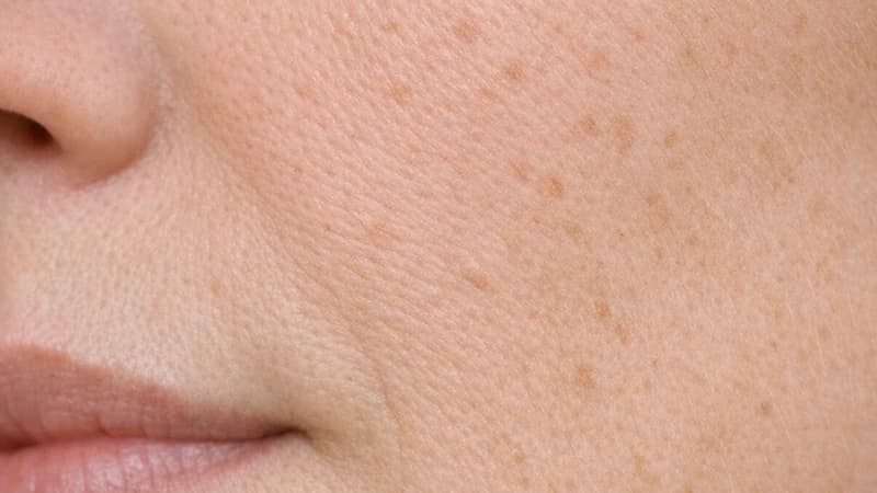 Natural matte cheek skin with freckles
