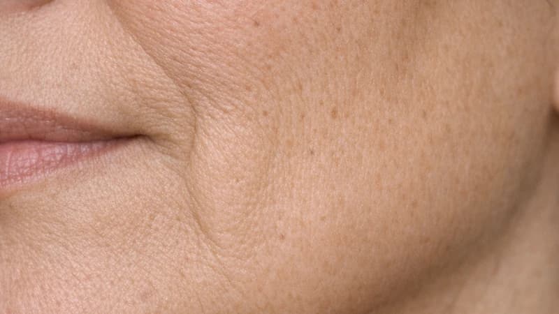 Natural folds beside the mouth on mature skin